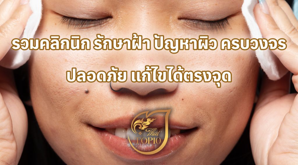 รวมคลิกนิก รักษาฝ้า ปัญหาผิว ครบวงจร ปลอดภัย แก้ไขได้ตรงจุด