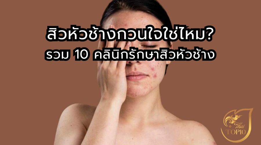 สิวหัวช้างกวนใจใช่ไหม? รวม 10 คลินิกรักษาสิวหัวช้าง