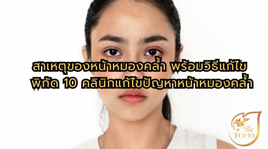 สาเหตุของหน้าหมองคล้ำ พร้อมวิธีแก้ไข พิกัด 10 คลินิกแก้ไขปัญหาหน้าหมองคล้ำ