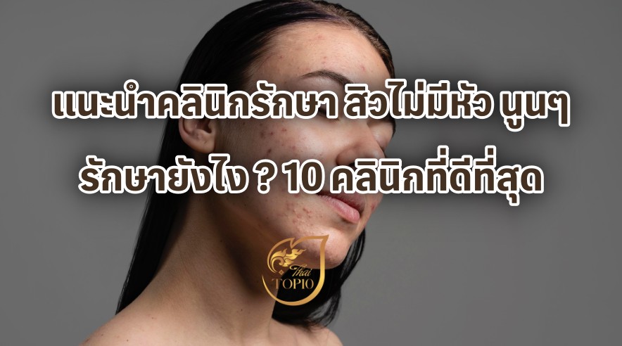 แนะนำคลินิกรักษา สิวไม่มีหัว นูนๆ รักษายังไง ? 10 คลินิกที่ดีที่สุด