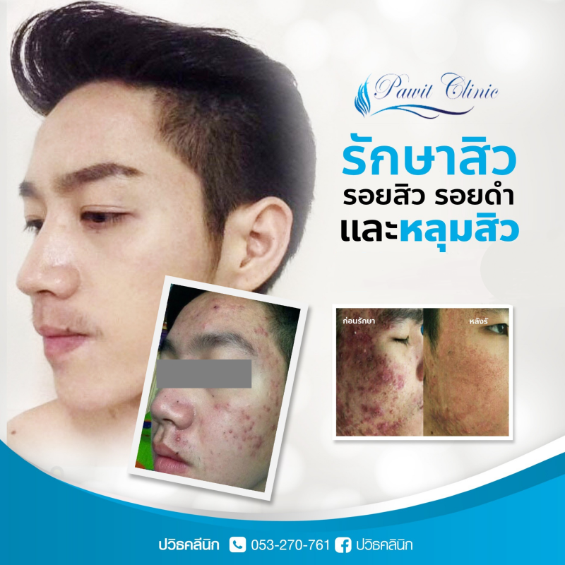 ปวิธคลินิก